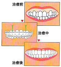 K~[tFCXÖ@